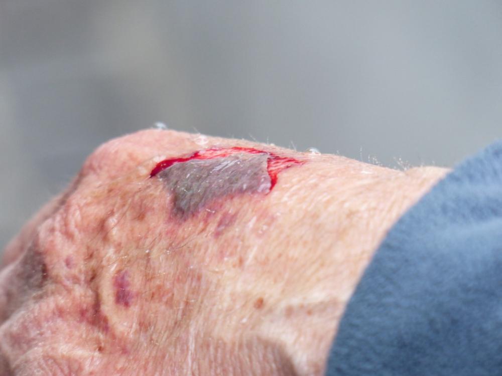 Hand Injury Wound Blood Crack Bloody Wounding Hand Injury Wound Blood Crack Bloody Wounding
