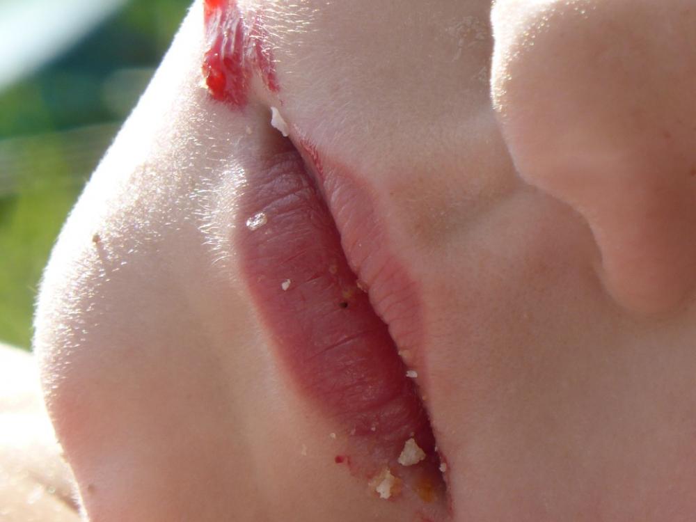 Mouth Child Child'S Mouth Jam Eat Crumb Lips Mouth Child Child'S Mouth Jam Eat Crumb Lips