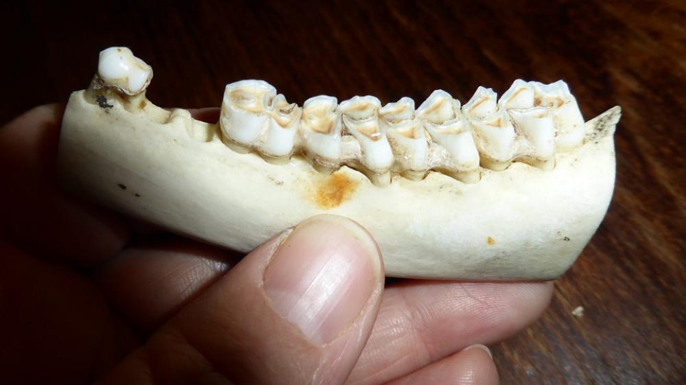 Teeth Tooth Dental Caries Bone Skeleton Teeth Tooth Dental Caries Bone Skeleton