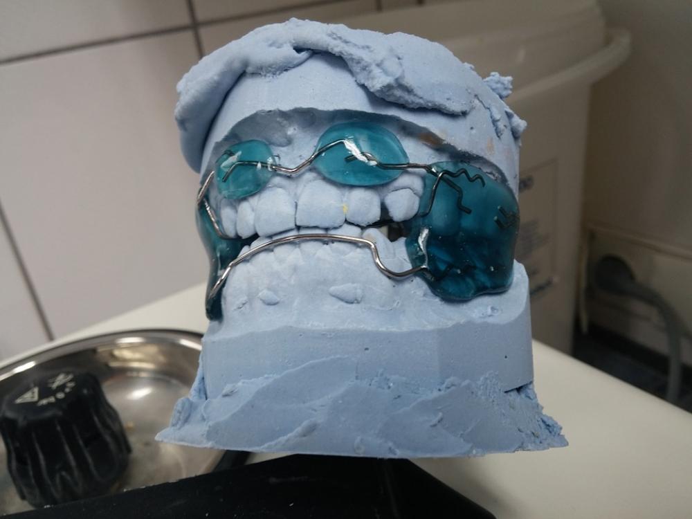 Dentist Orthodontics Dental Rail Rails Dentist Orthodontics Dental Rail Rails