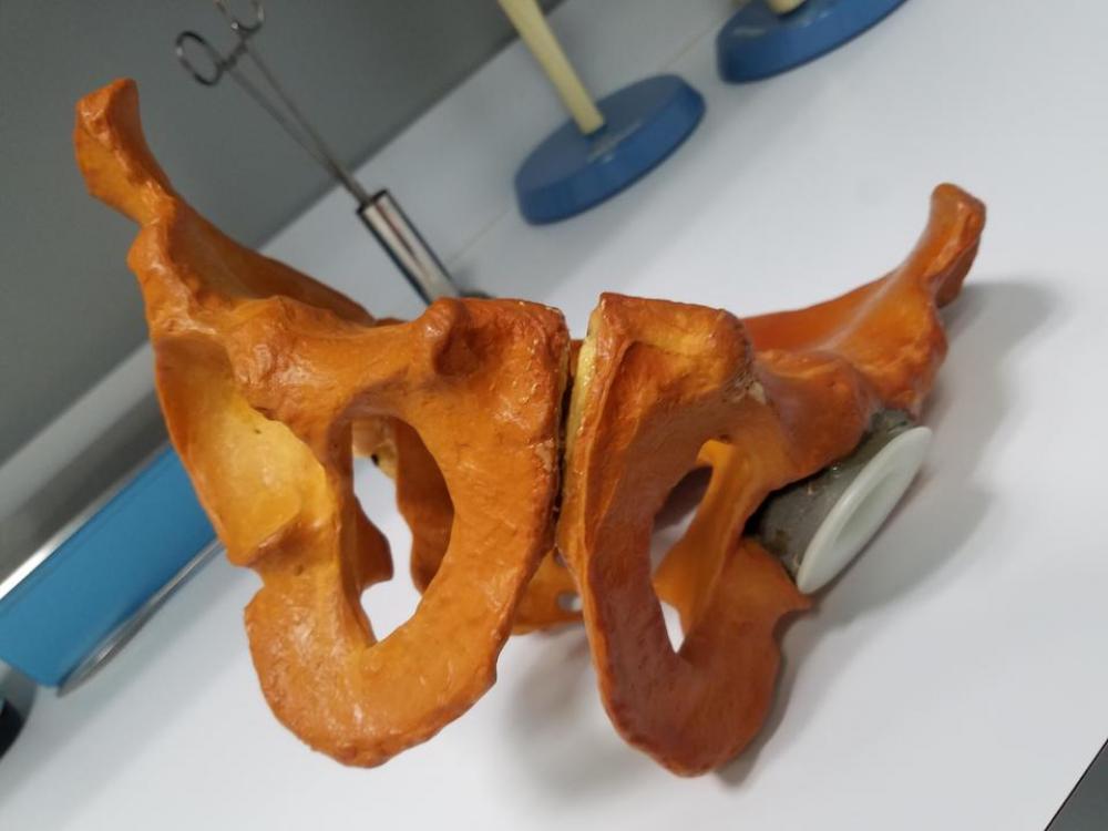 Hip prosthetic bone medical Hip prosthetic bone medical