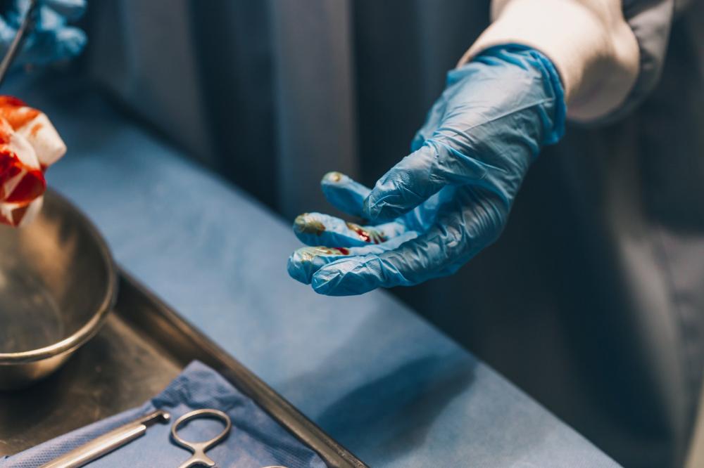 A Surgeon Handles Gauze Pad And Surgical Equipment Photo A Surgeon Handles Gauze Pad And Surgical Equipment Photo