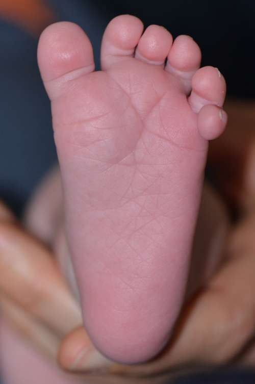 Baby Foot Foot Toes Six Toes
