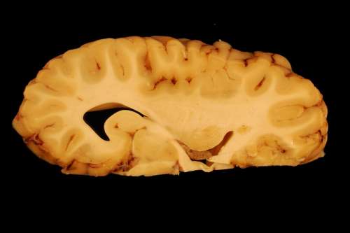 Brain Anatomy Eyes Paerparat Horse Biology Body