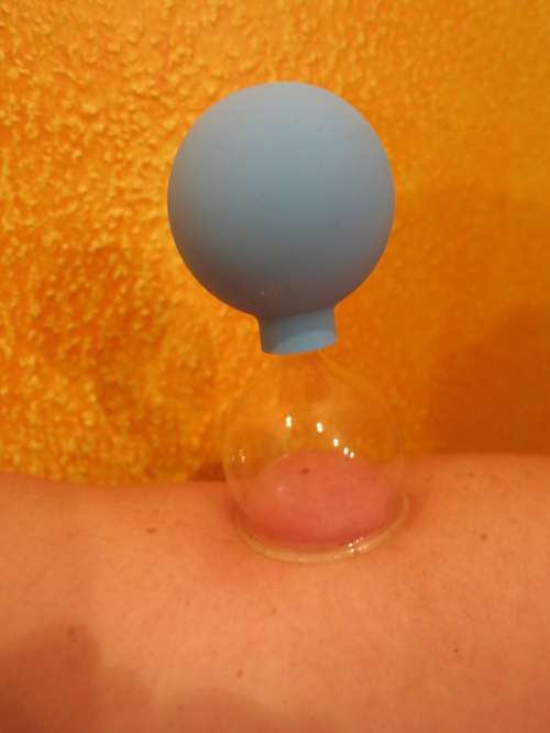 Cupping Massage Cupping Massage Arm Dent Skin