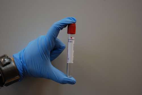 Laboratory Medical Lab Diagnostics Blood Tube