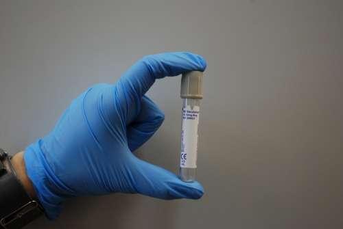 Laboratory Medical Lab Diagnostics Blood Tube