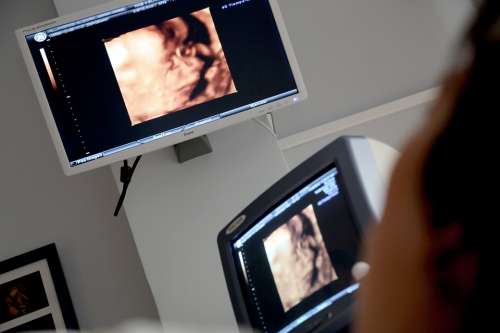 Monitor Ultrasound Medical Consultation Diagnosis