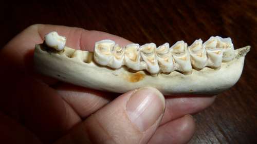 Teeth Tooth Dental Caries Bone Skeleton