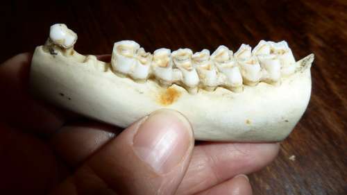 Teeth Tooth Dental Caries Bone Skeleton