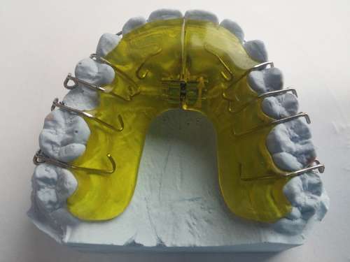 Dental Braces Dentist Orthodontics Dental Rail