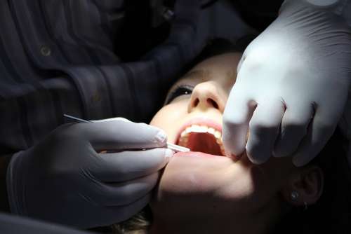 Zahnreinigung Dental Repairs Treat Teeth