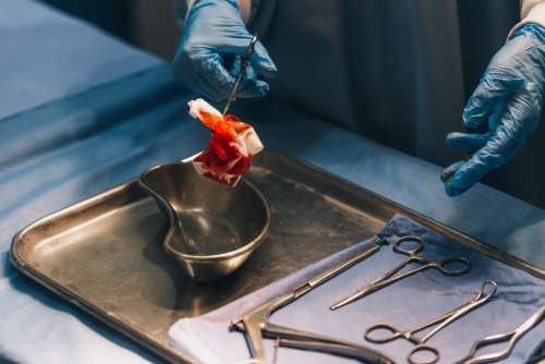 A Surgeon Handles Bloody Gauze Pad Photo