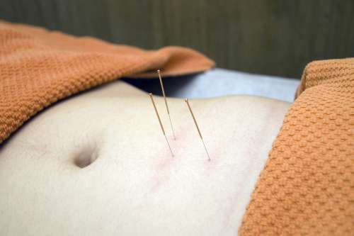 Acupuncture Physiotherapy Wellness Relax Bless You
