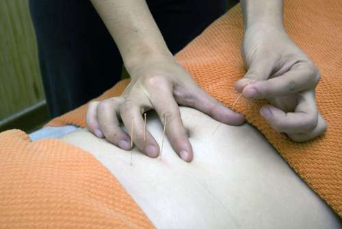 Acupuncture Physiotherapy Wellness Relax Bless You