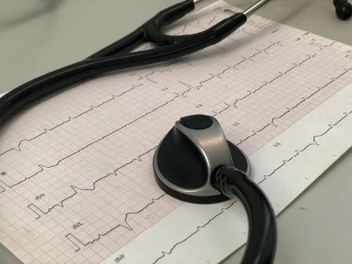 Ecg Medical Heart Ekg Healthcare Cardiac