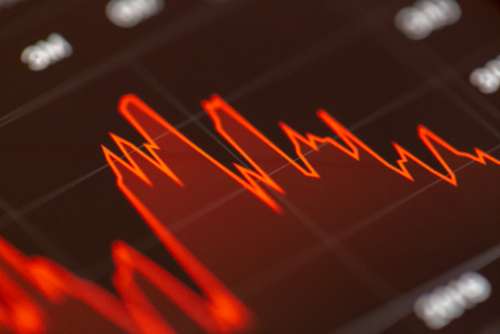 Stocks Graph Abstract Accounting Analysis