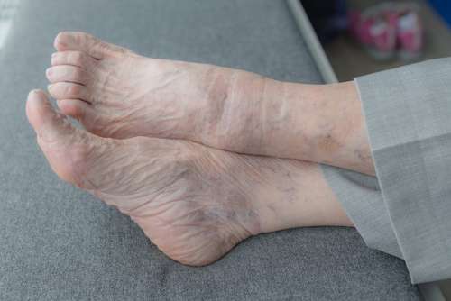 Feet Old Old Age Elderly Vulnerable Care
