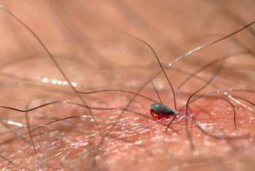 Tick Lyme B Parasite Nature Animal Dangerous