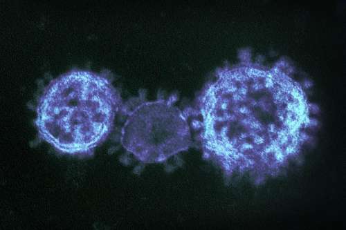 Coronavirus Under Electron Microscope